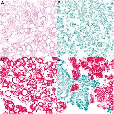 Differentiating Batrachochytrium dendrobatidis and B. salamandrivorans in Amphibian Chytridiomycosis Using RNAScope®in situ Hybridization